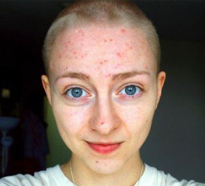 I Am Not My Skin Cover